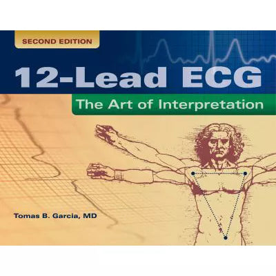 12-Lead ECG: Art of Interpretation