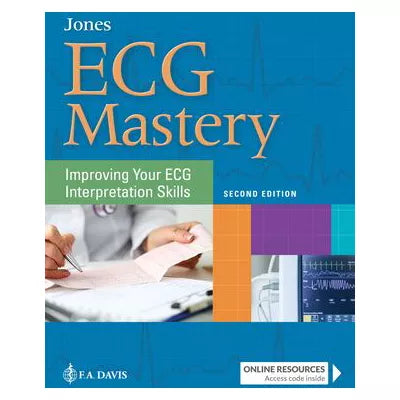 ECG Mastery